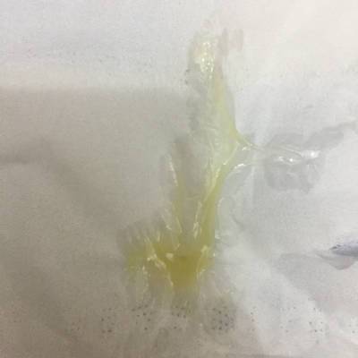 怀孕50天上厕所有点黄色的东西