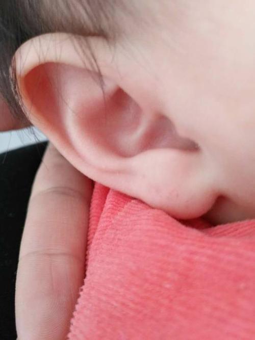孩子耳朵红怎么回事