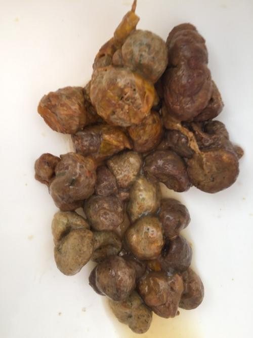 2岁孩子大便干燥怎么办