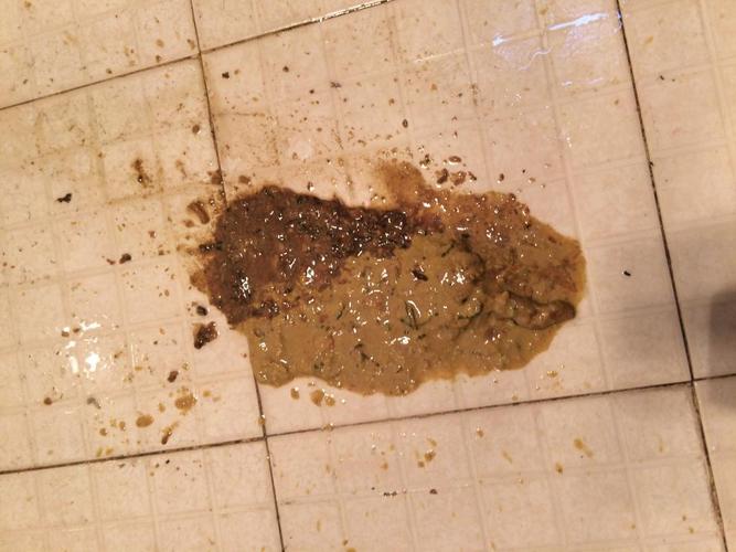 吃东西不消化拉稀