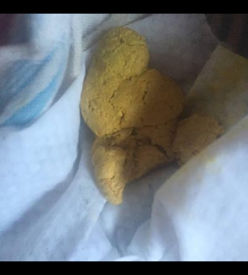 孩子两天不大便怎么办