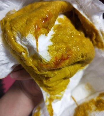 孩子大便有血怎么回事