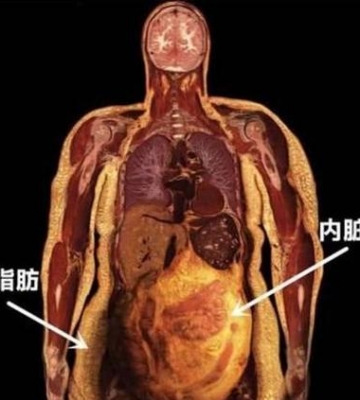 运动降内脏脂肪