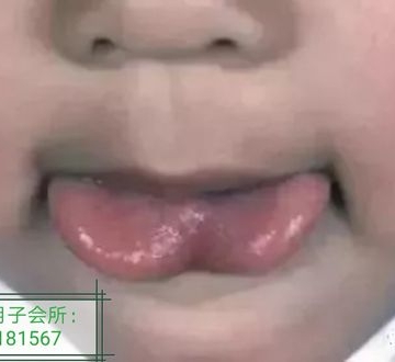 孩子总伸舌头怎么回事