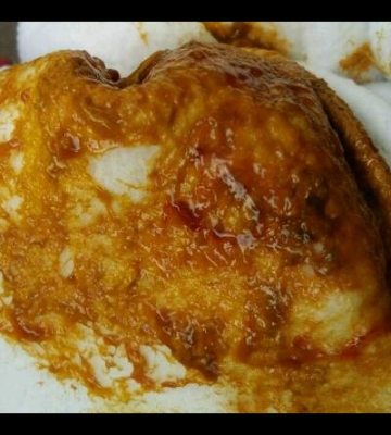 孩子三天不拉屎怎么办