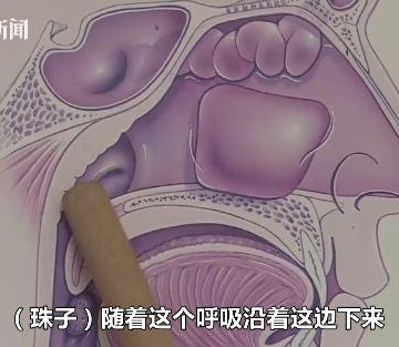 鼻子里卡了东西