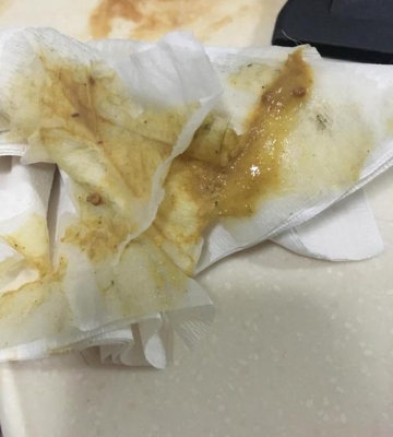 吃完东西老是吐