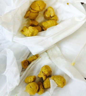 孩子拉不出来屎怎么办