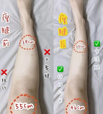 什么种类运动瘦腿