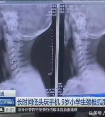 孩子颈椎不好怎么办