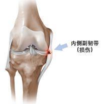 膝盖韧带拉伤可以做什么运动