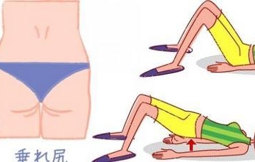 哪些运动可以瘦屁股
