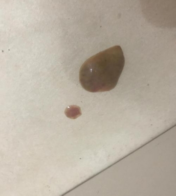 猫咪拉稀要吃什么东西怎么办