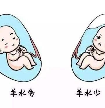孩子羊水少怎么办