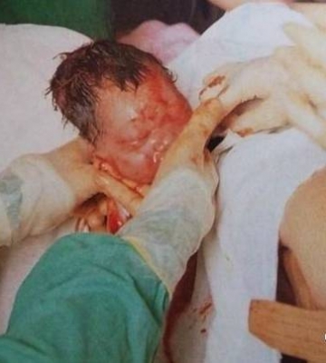 怎么样才能生孩子