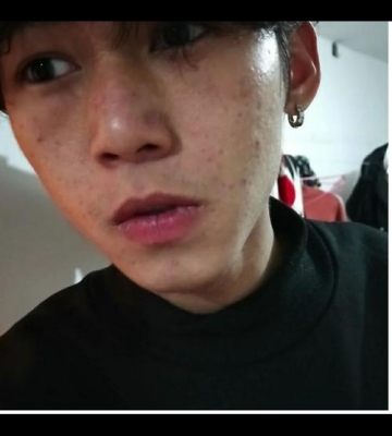 男孩子皮肤黑怎么变白