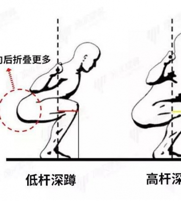 深蹲髋关节运动损伤