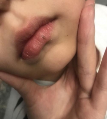 小孩子嘴唇发黑怎么回事