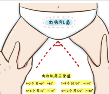 怎么判断孩子肌张力高