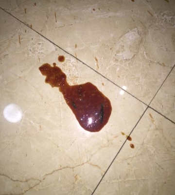 狗狗拉肚子呕吐不吃东西怎么回事怎