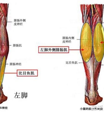运动后小腿肌肉胀痛