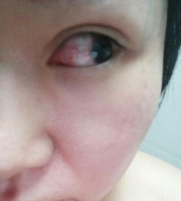 冲着东西了 眼睛红