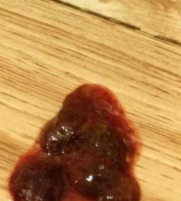 狗不吃东西便血怎么办