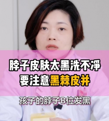 孩子黑怎么办