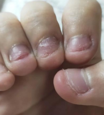 小孩子咬手指甲是怎么回事