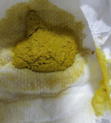 孩子拉粑粑干燥怎么办