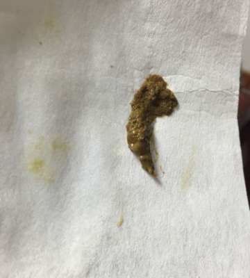 狗狗大便带鼻涕状东西怎么回事