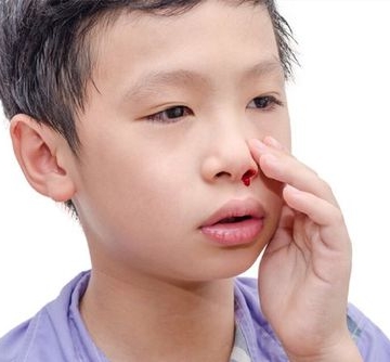 小孩子流鼻血怎么办