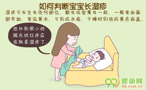 如何应对湿疹