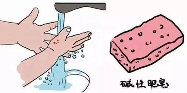 如何防止剪伤