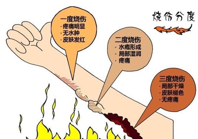 怎么避免烫伤