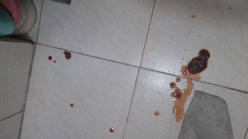 狗狗大便带血应该喂什么