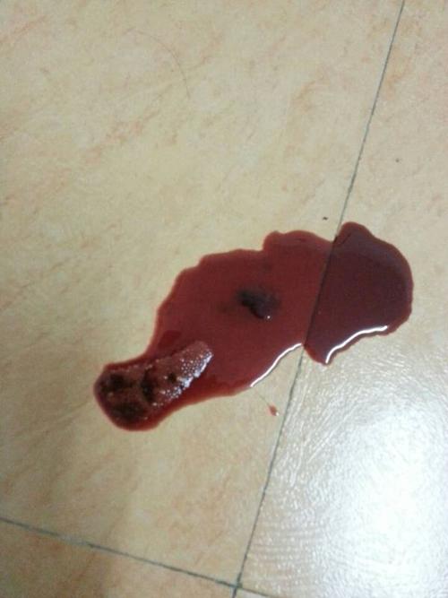 为什么狗狗会便血