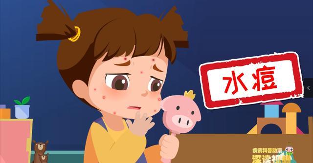 如何防止水痘
