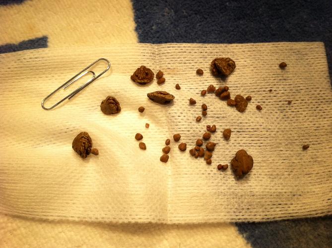 狗狗膀胱结石排出的是什么