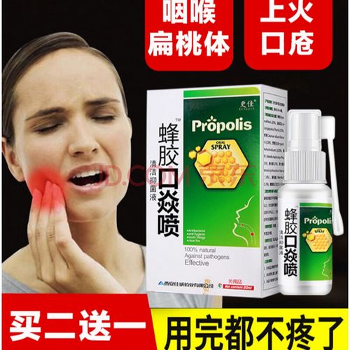 如何快速止口炎