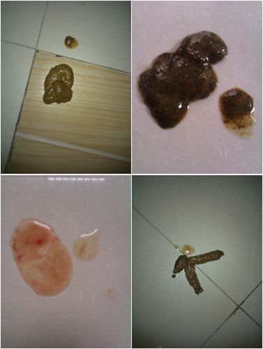 狗狗细小刚好吃什么