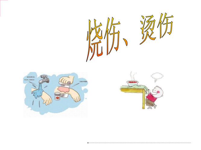 如何防止被烧伤