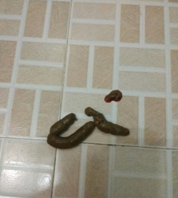 小狗便便带血怎么治疗