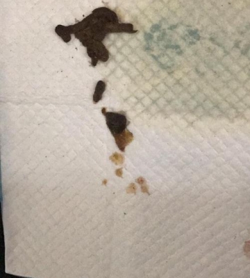 狗狗拉黑大便怎么回事