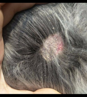 狗狗长皮癣什么样子的