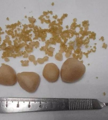 狗狗得了尿结石为什么