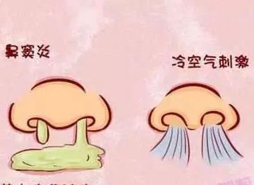 如何处理鼻塞
