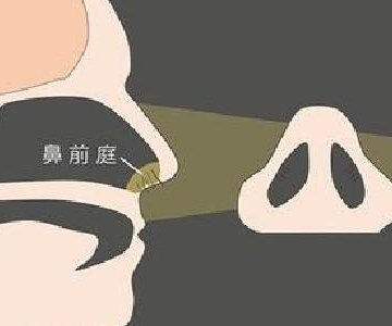 如何预防鼻疾病