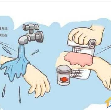 如何避免厨房烧伤