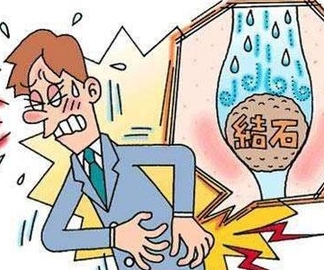 如何避免肾结石